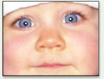 Pink eye (conjunctivitis) - Mayo Clinic